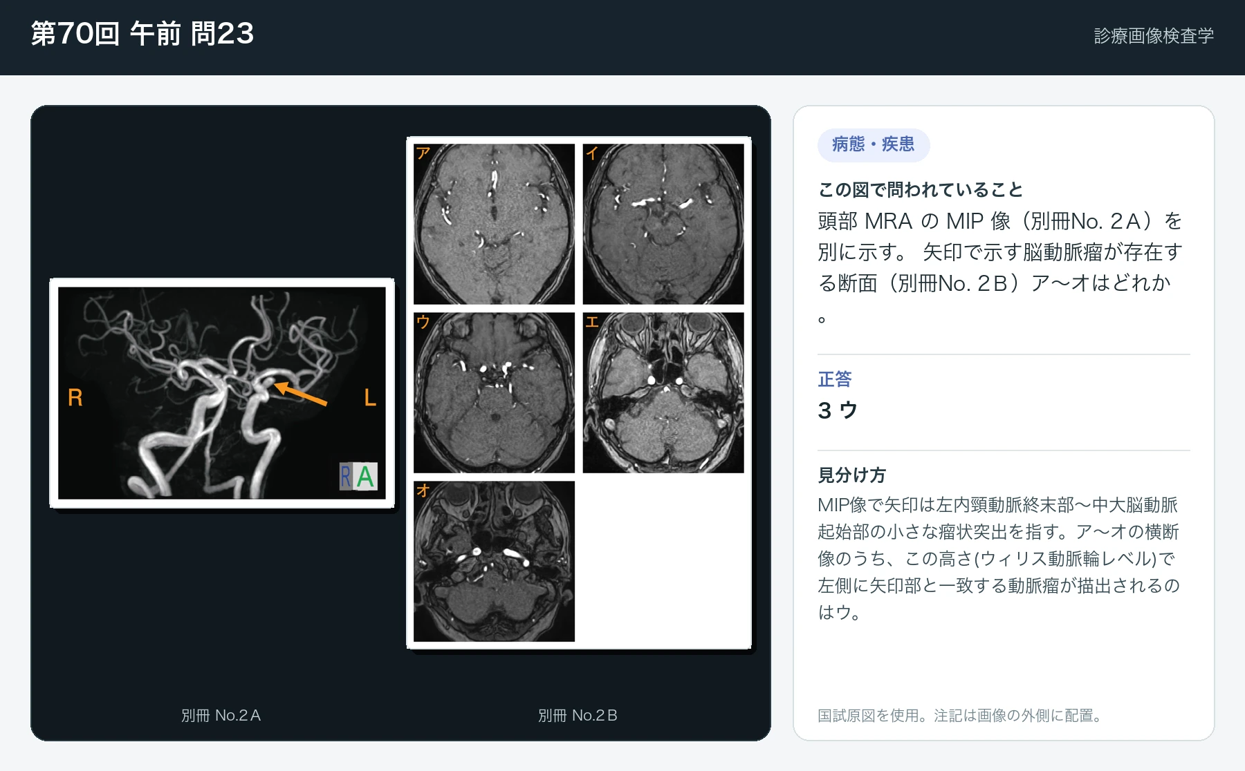 第70回 午前23の画像と見分け方