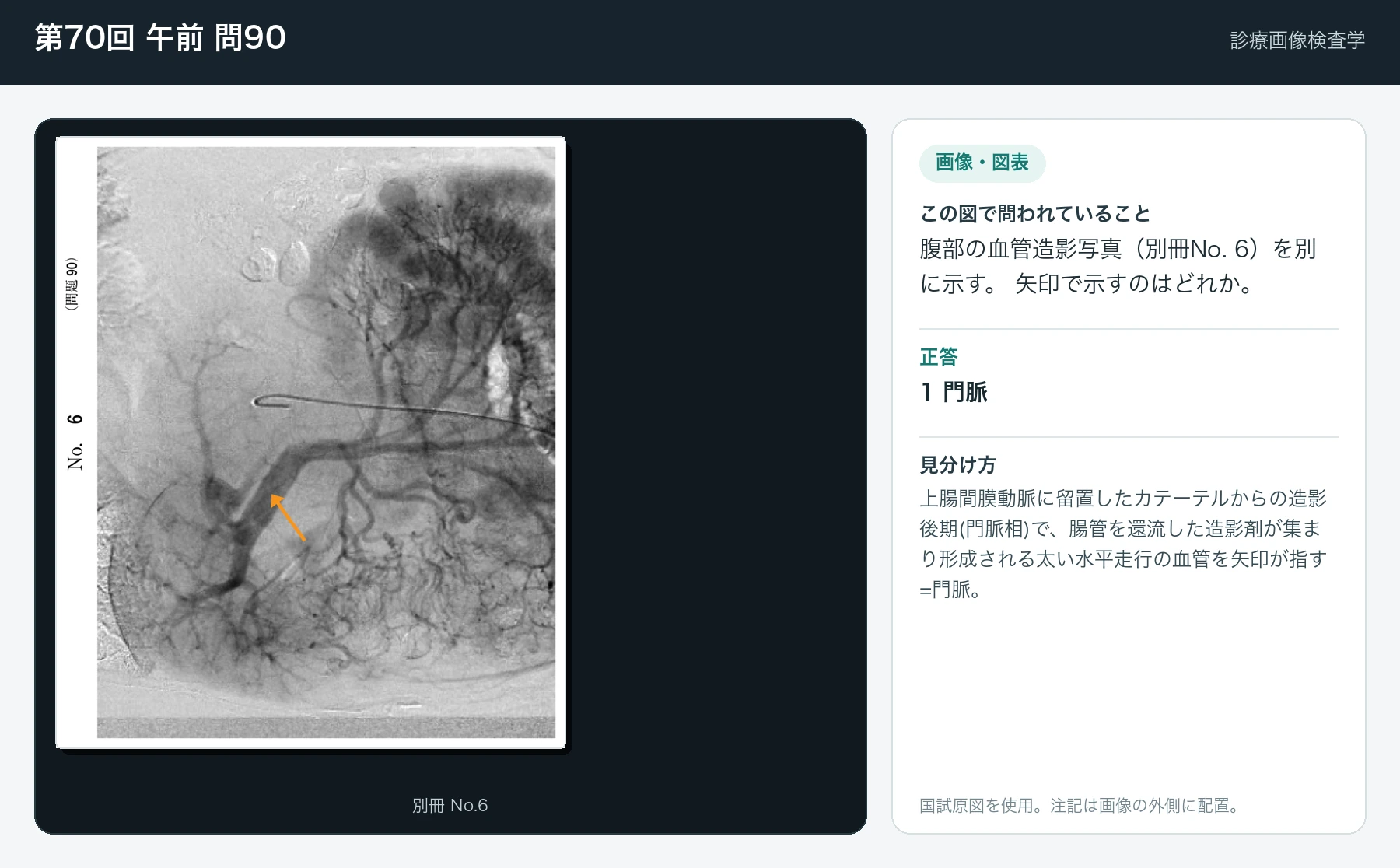 第70回 午前 問90の画像と見分け方