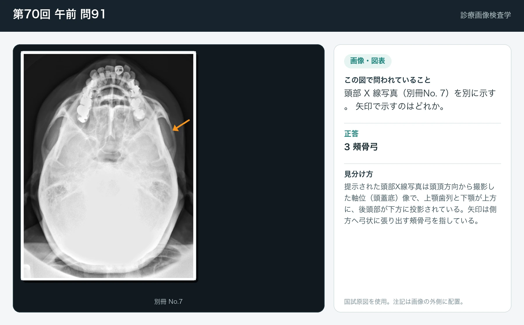 第70回 午前91の画像と見分け方
