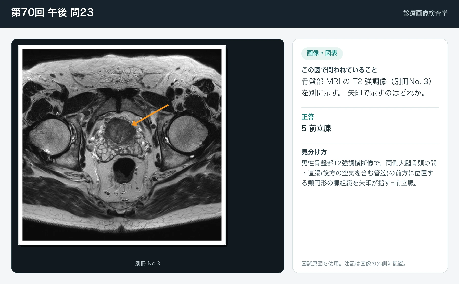 第70回 午後 問23の画像と見分け方