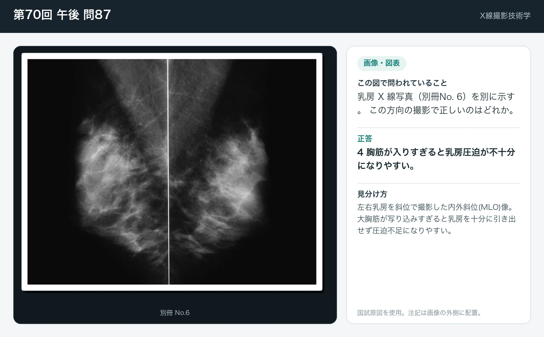 第70回 午後 問87の画像と見分け方