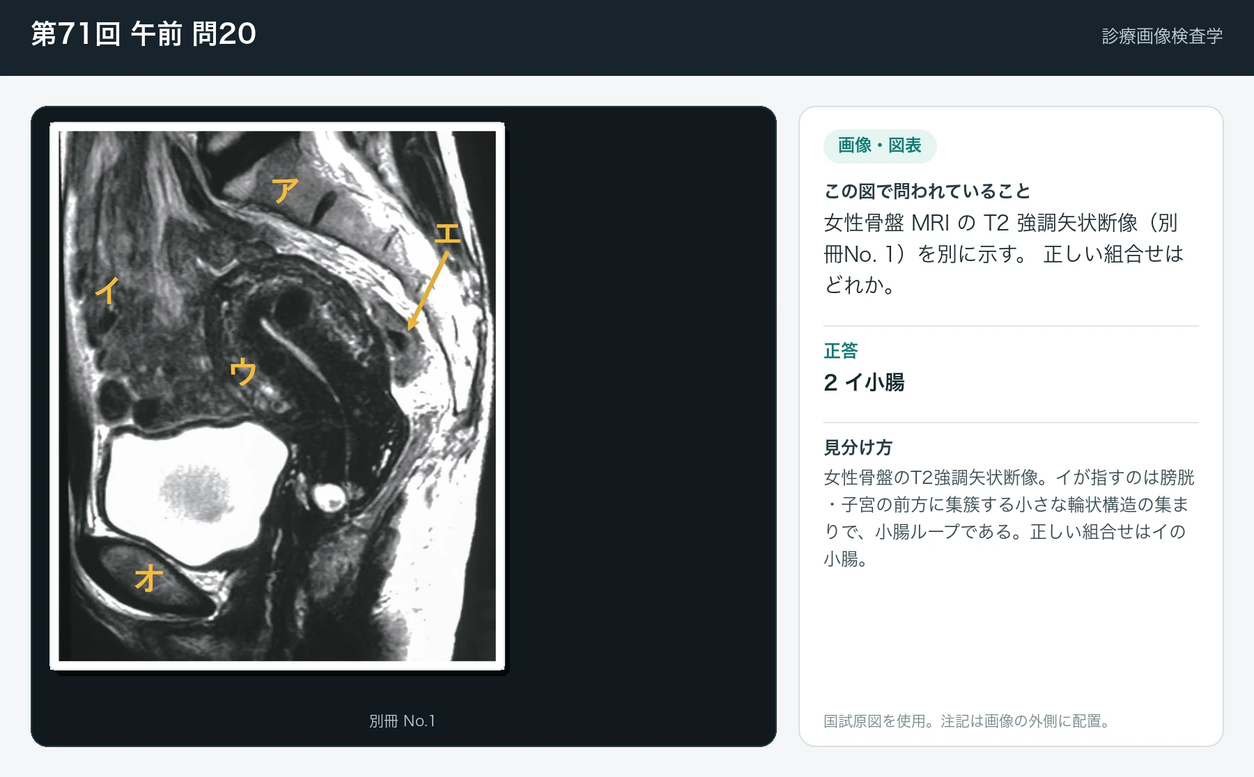 第71回 午前 問20の画像と見分け方