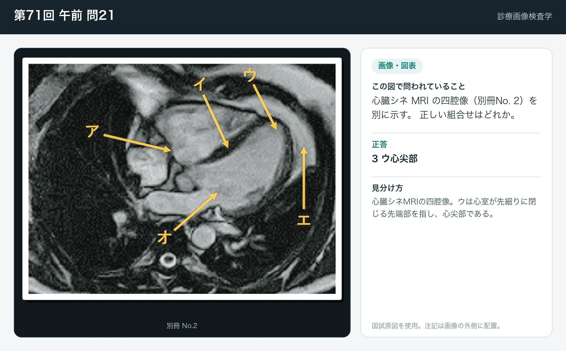 第71回 午前 問21の画像と見分け方