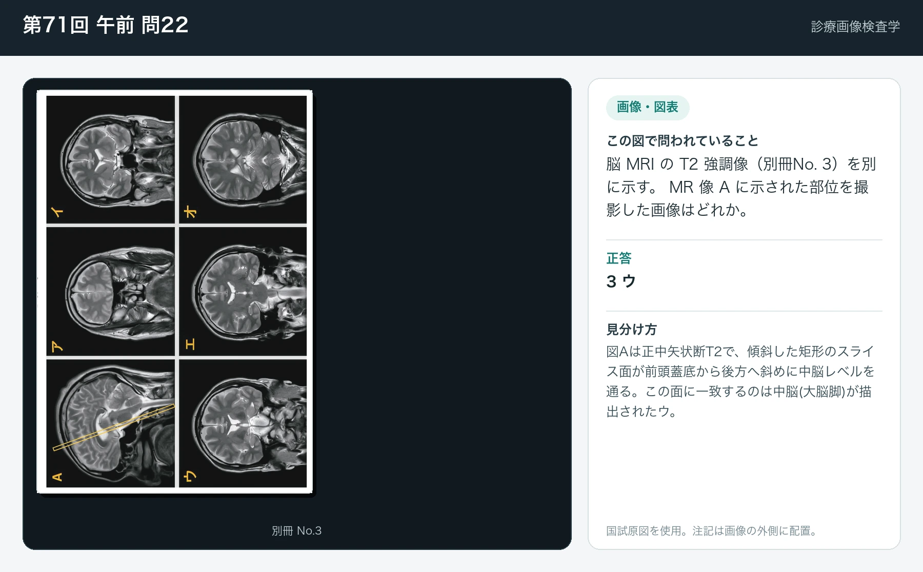 第71回 午前 問22の画像と見分け方