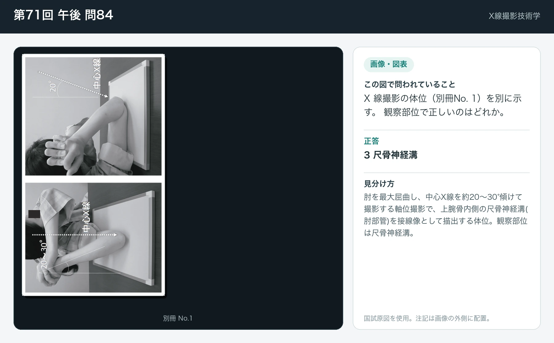 第71回 午後 問84の画像と見分け方
