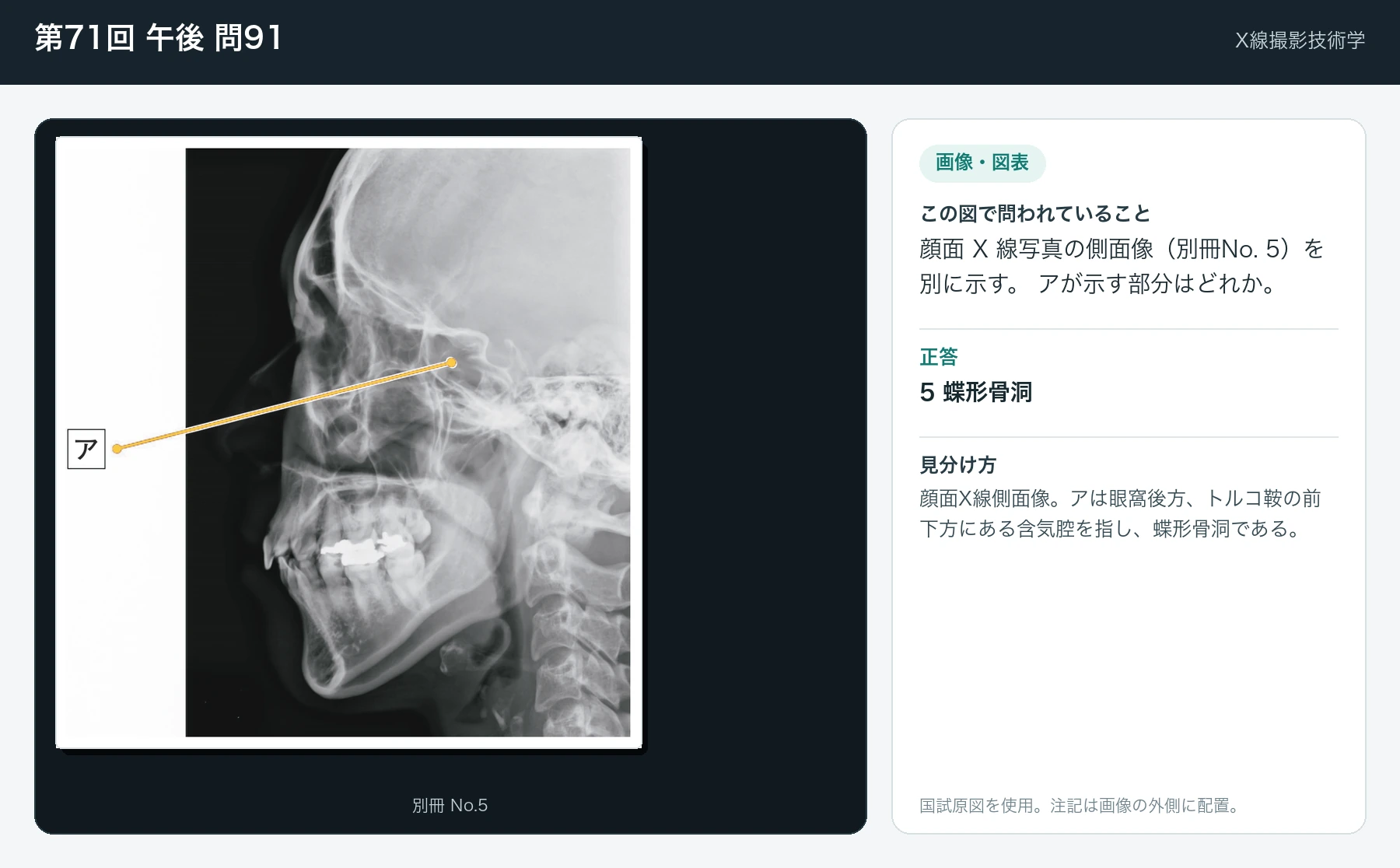 第71回 午後 問91の画像と見分け方