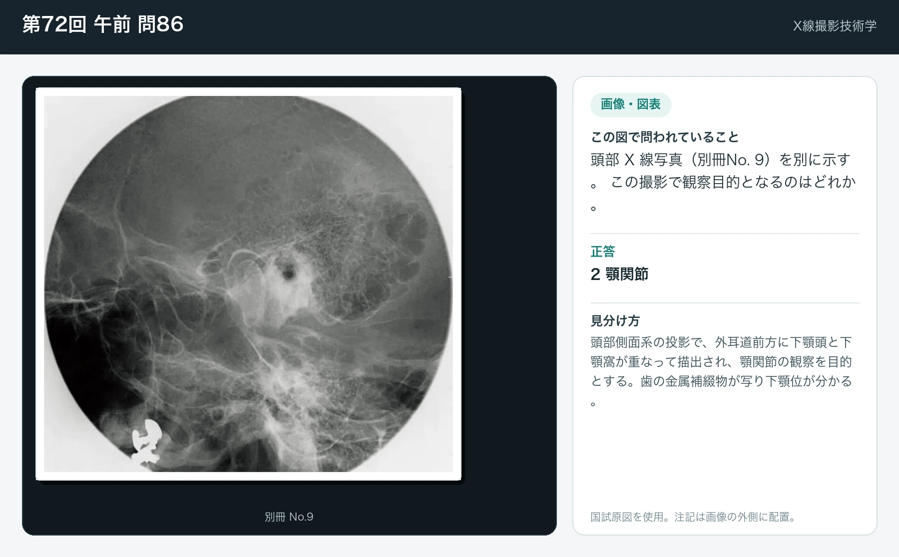 第72回 午前 問86の画像と見分け方