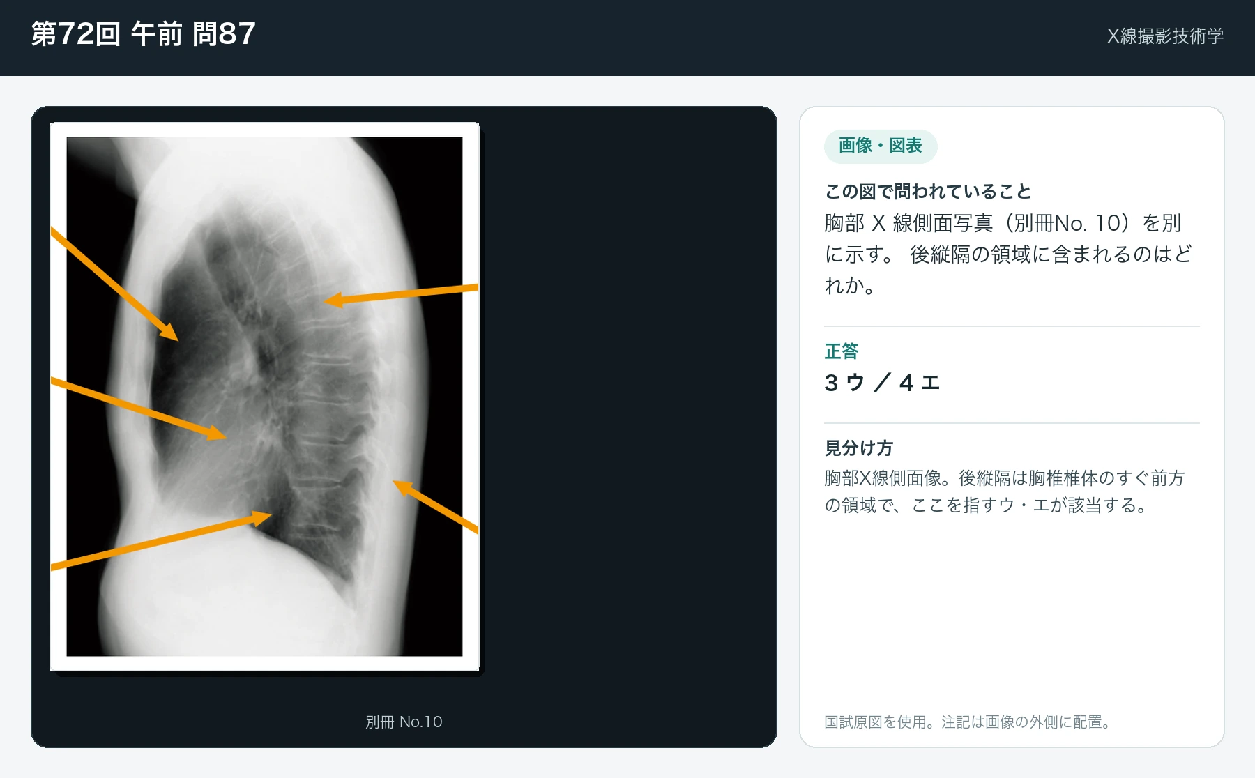 第72回 午前 問87の画像と見分け方