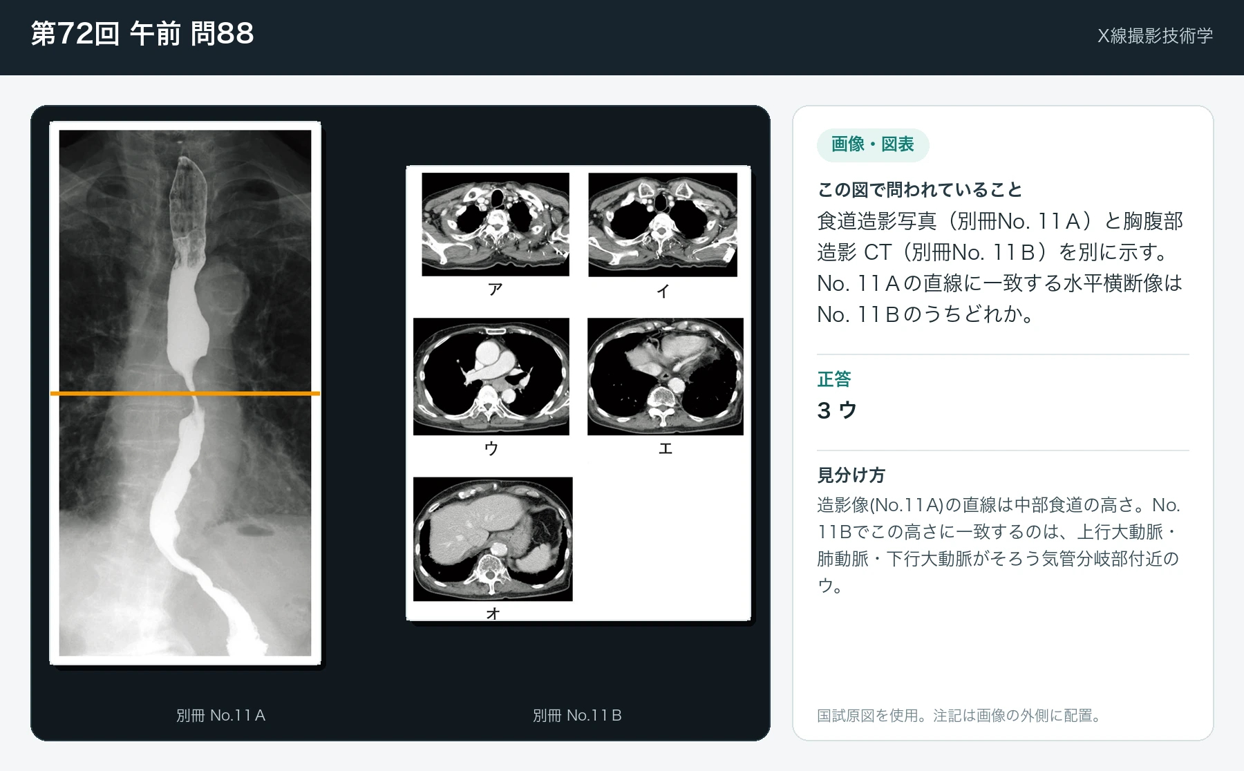第72回 午前 問88の画像と見分け方