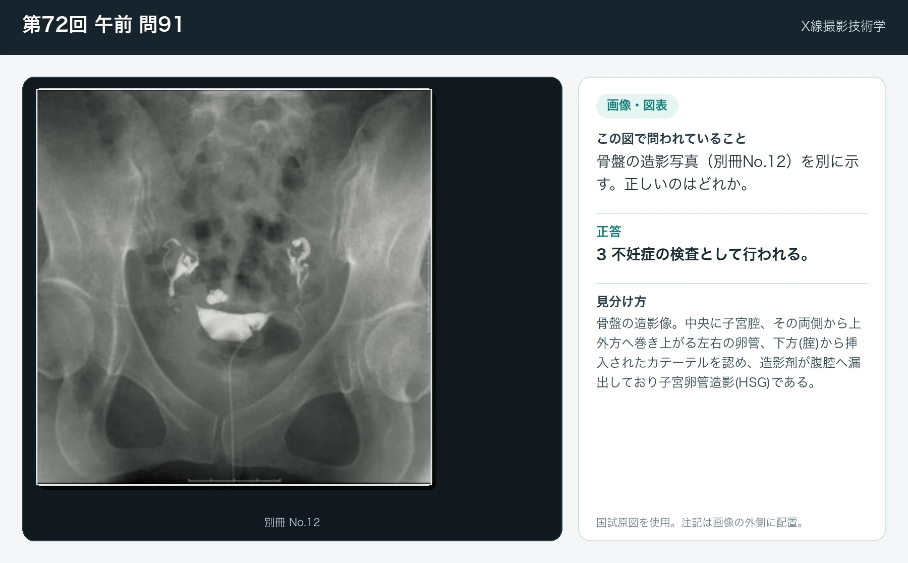 第72回 午前91の画像と見分け方