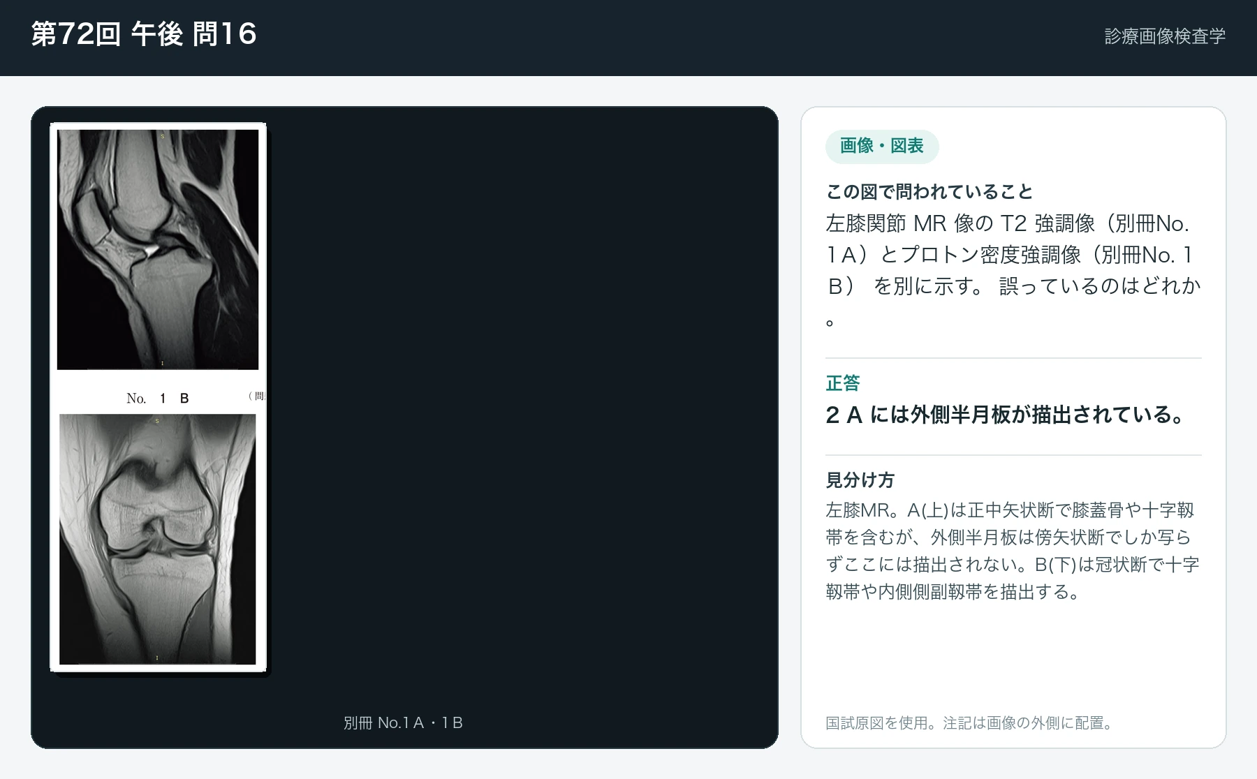 第72回 午後 問16の画像と見分け方