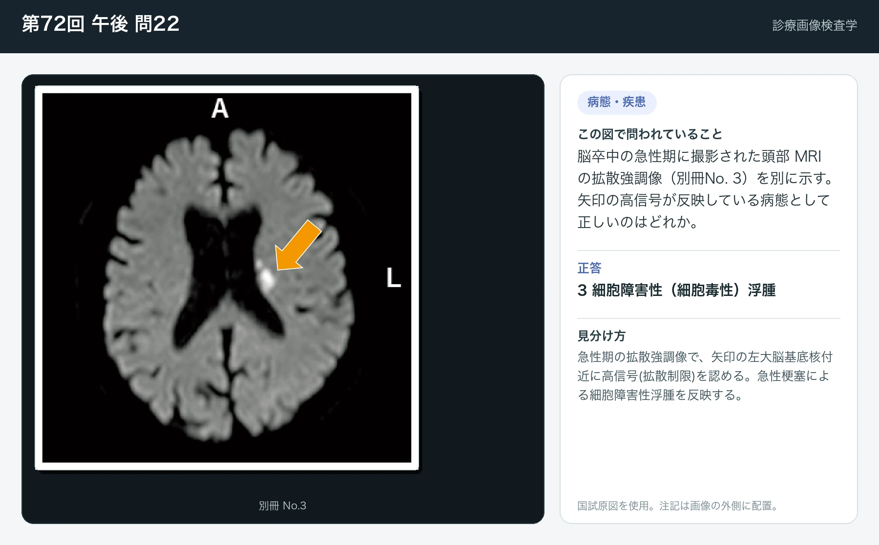 第72回 午後 問22の画像と見分け方