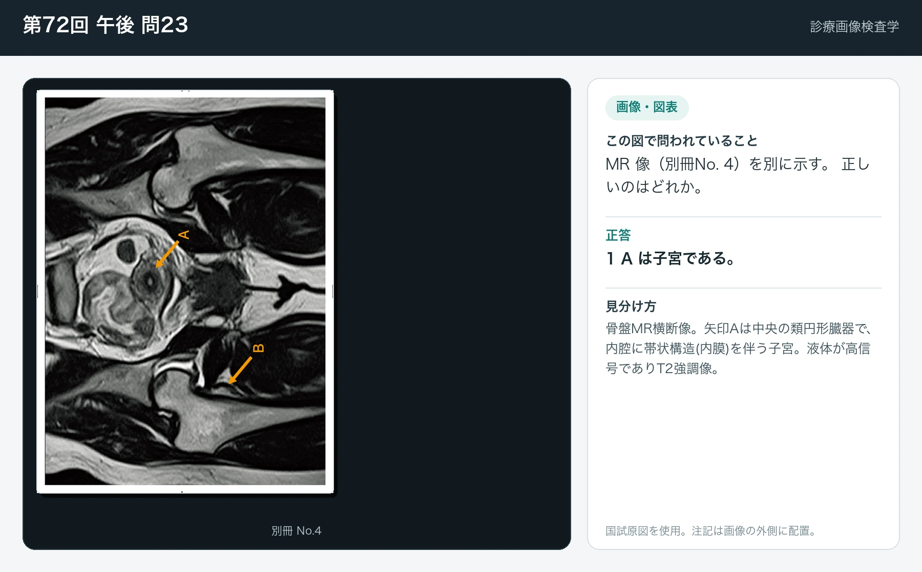第72回 午後 問23の画像と見分け方