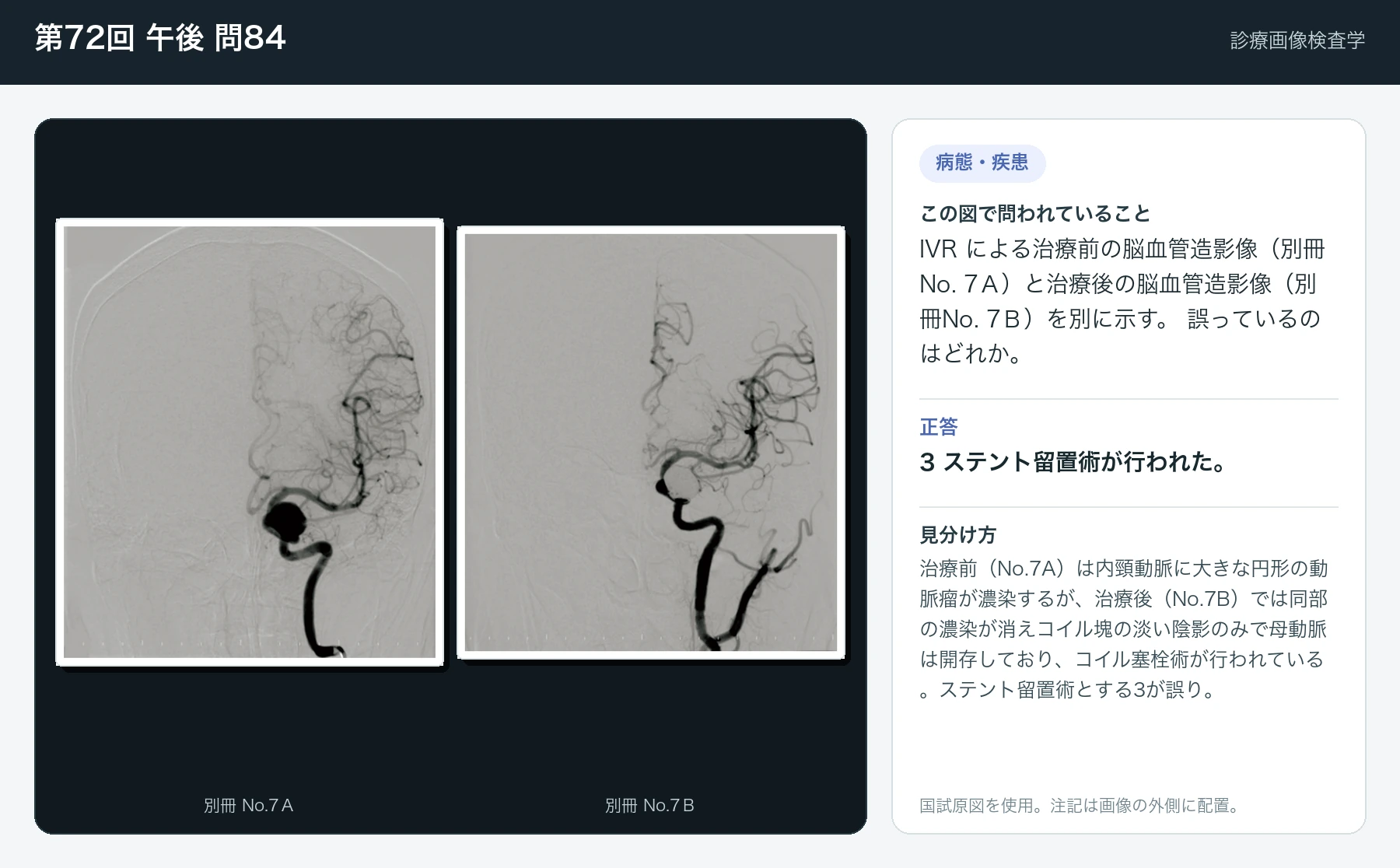 第72回 午後 問84の画像と見分け方