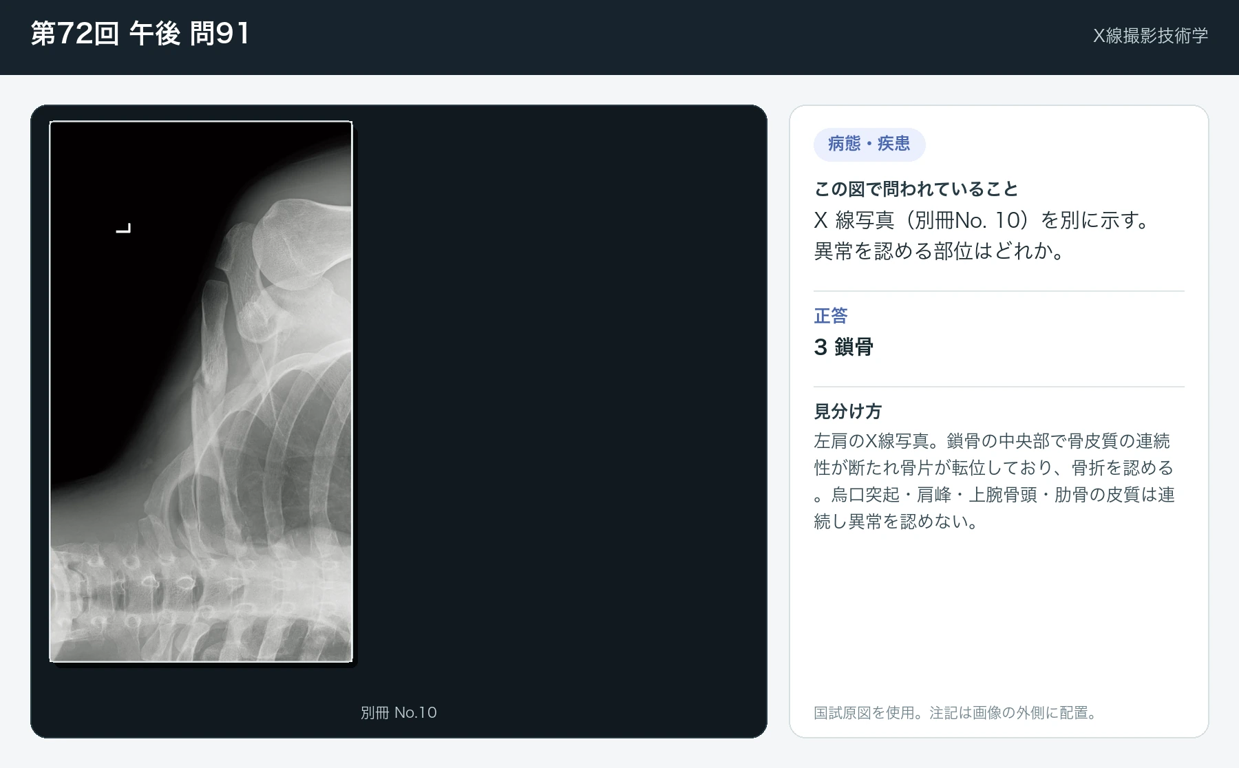 第72回 午後 問91の画像と見分け方