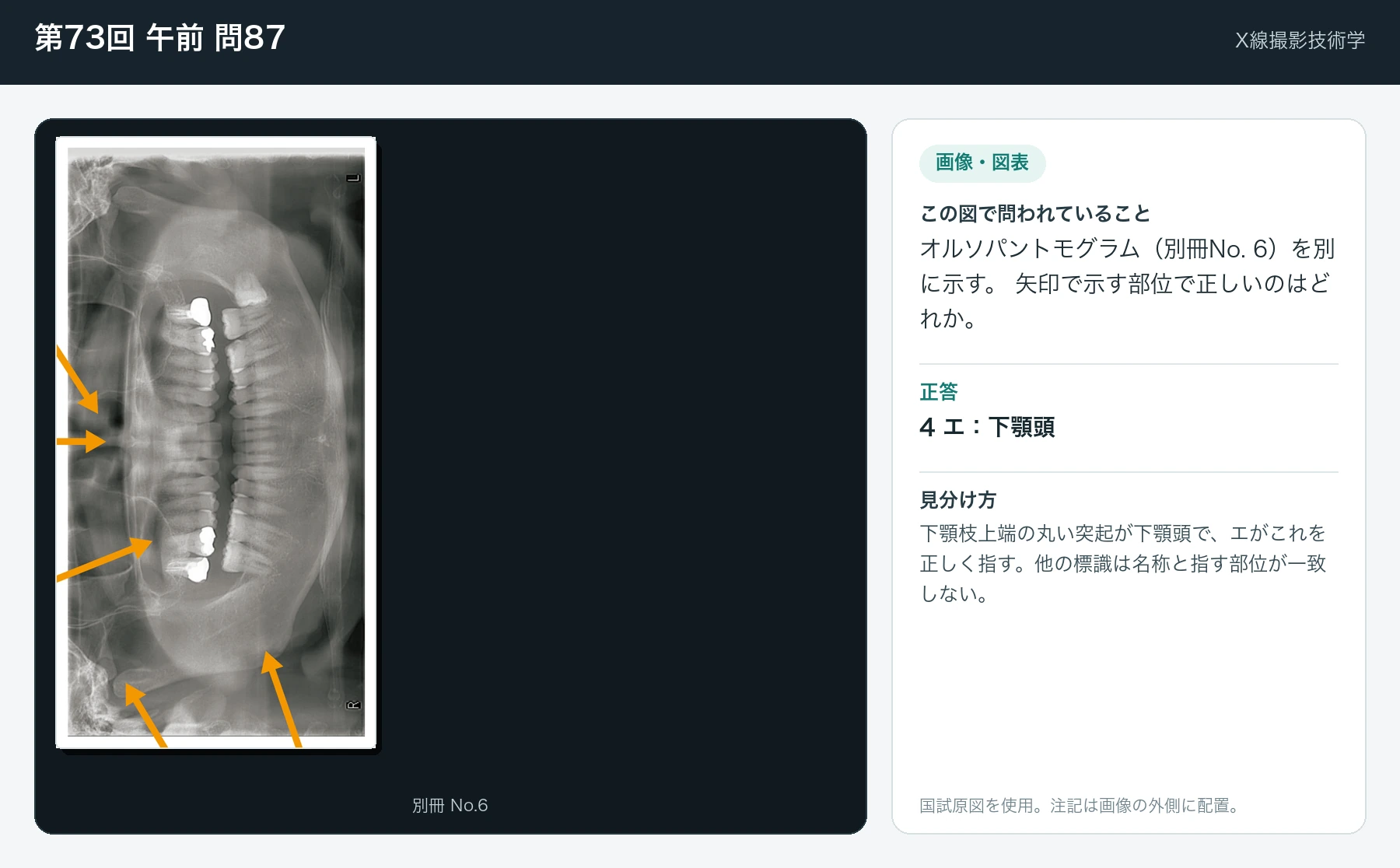 第73回 午前 問87の画像と見分け方
