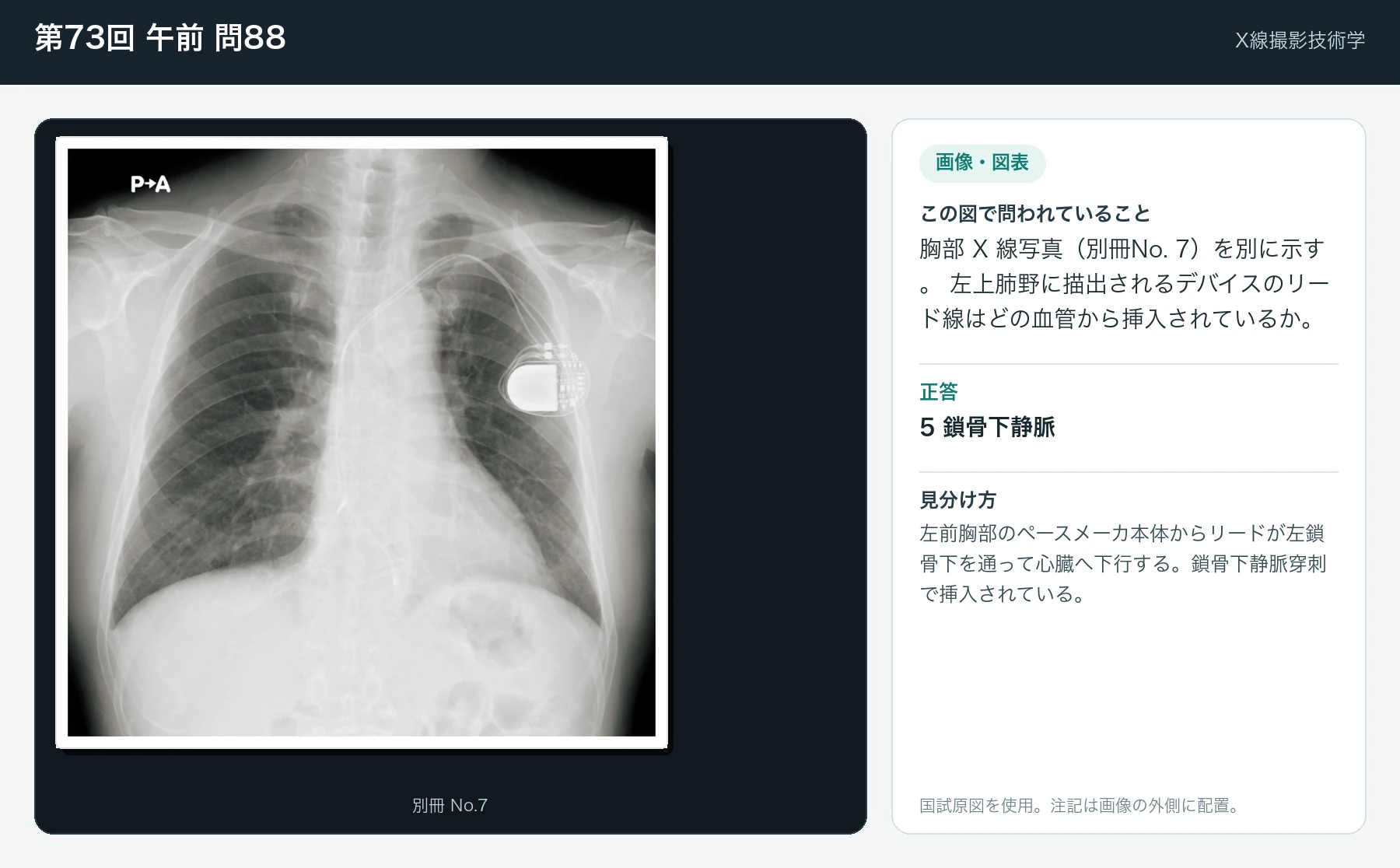 第73回 午前 問88の画像と見分け方