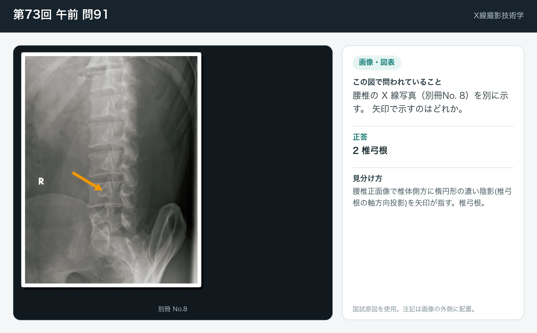 第73回 午前 問91の画像と見分け方