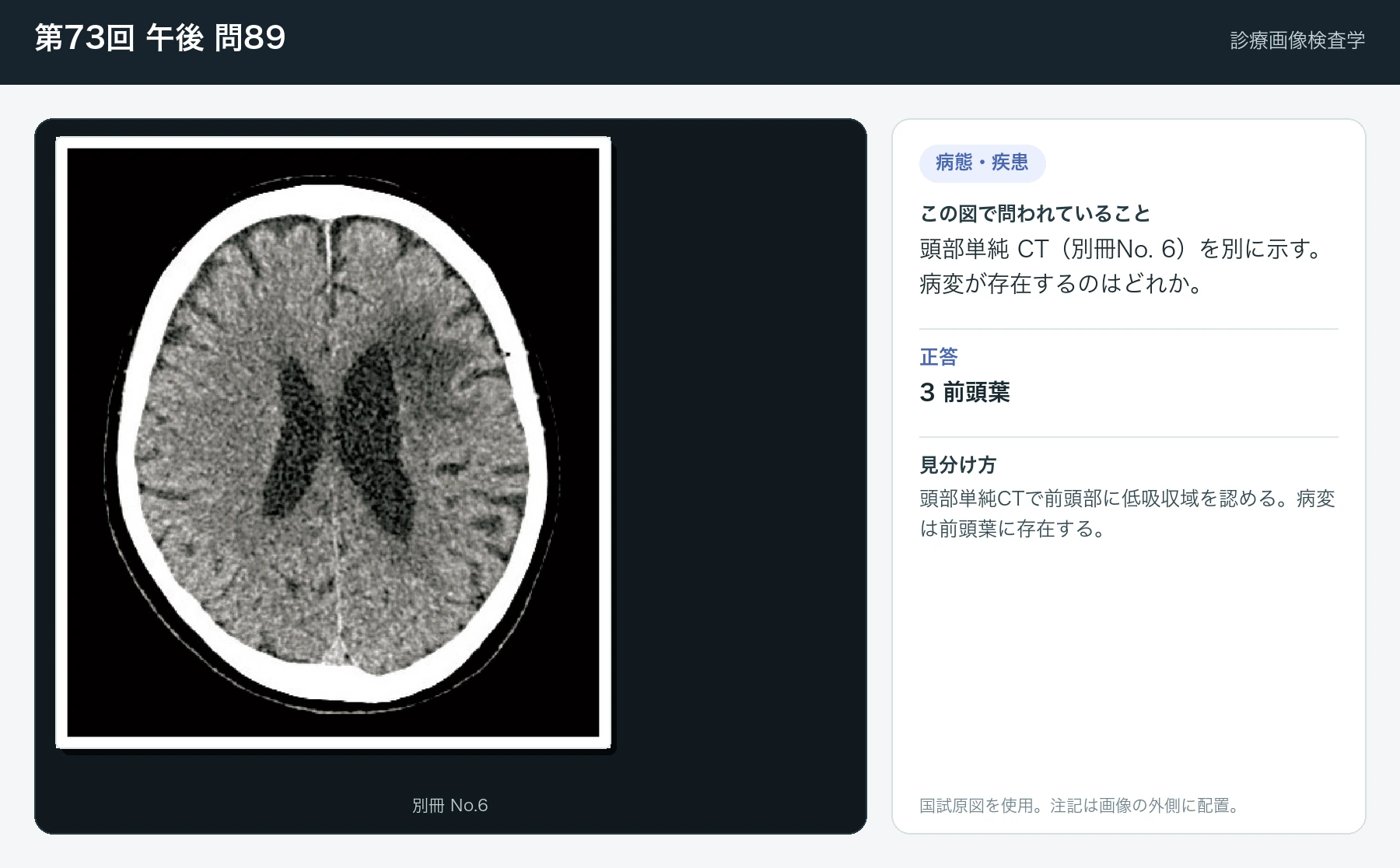 第73回 午後 問89の画像と見分け方