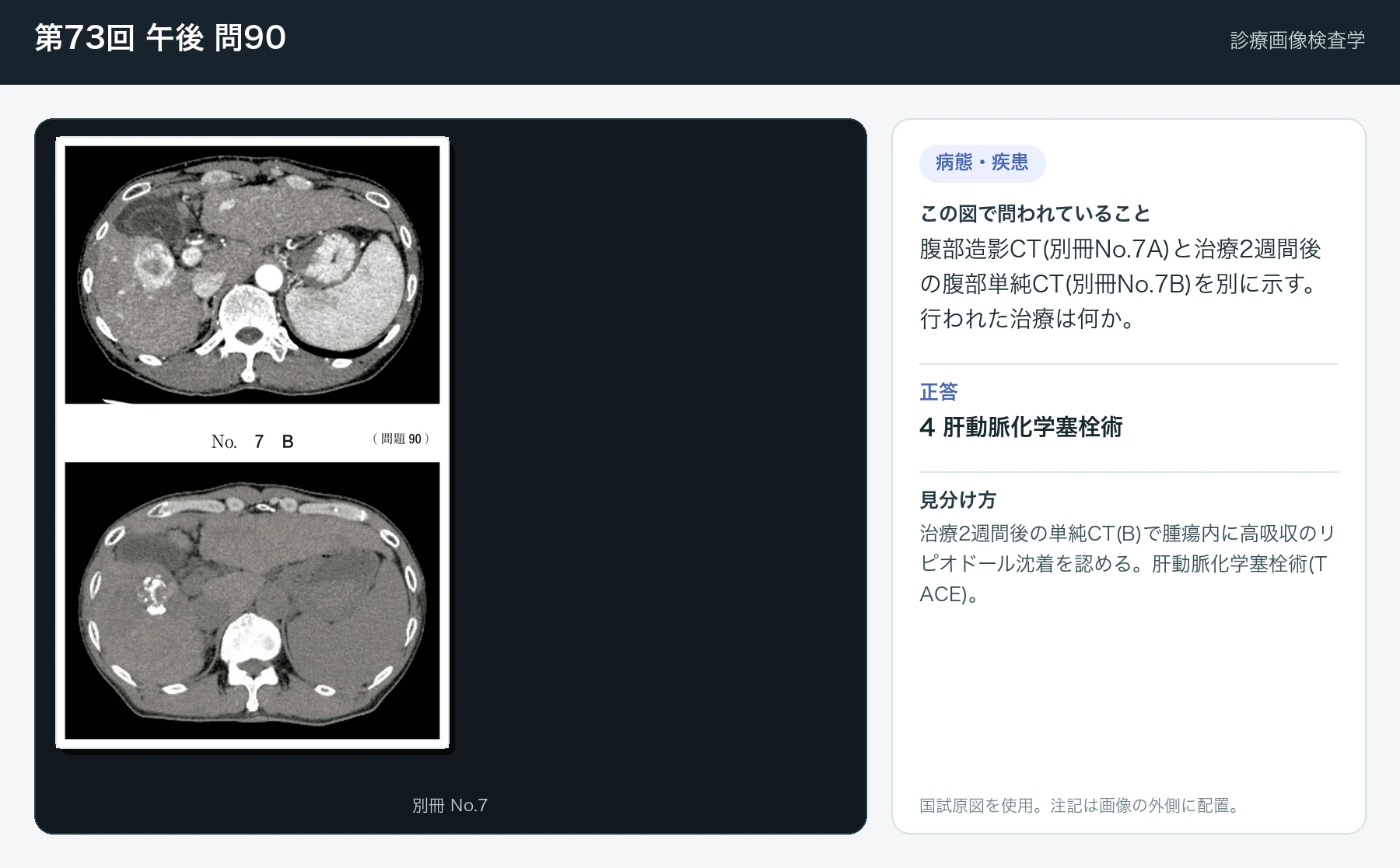 第73回 午後 問90の画像と見分け方