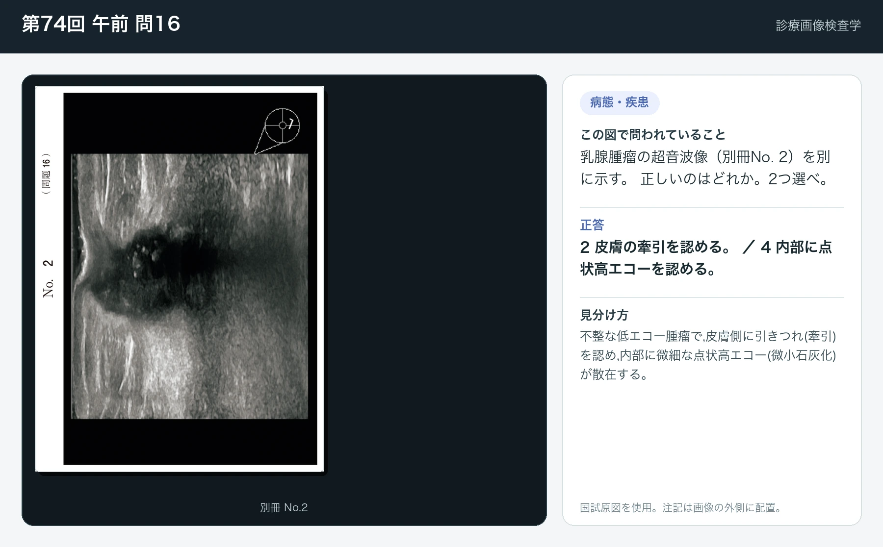 第74回 午前 問16の画像と見分け方