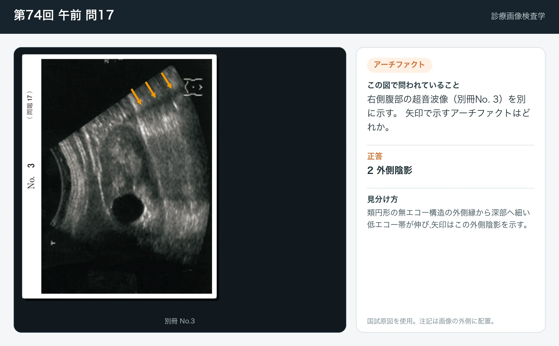 第74回 午前 問17の画像と見分け方
