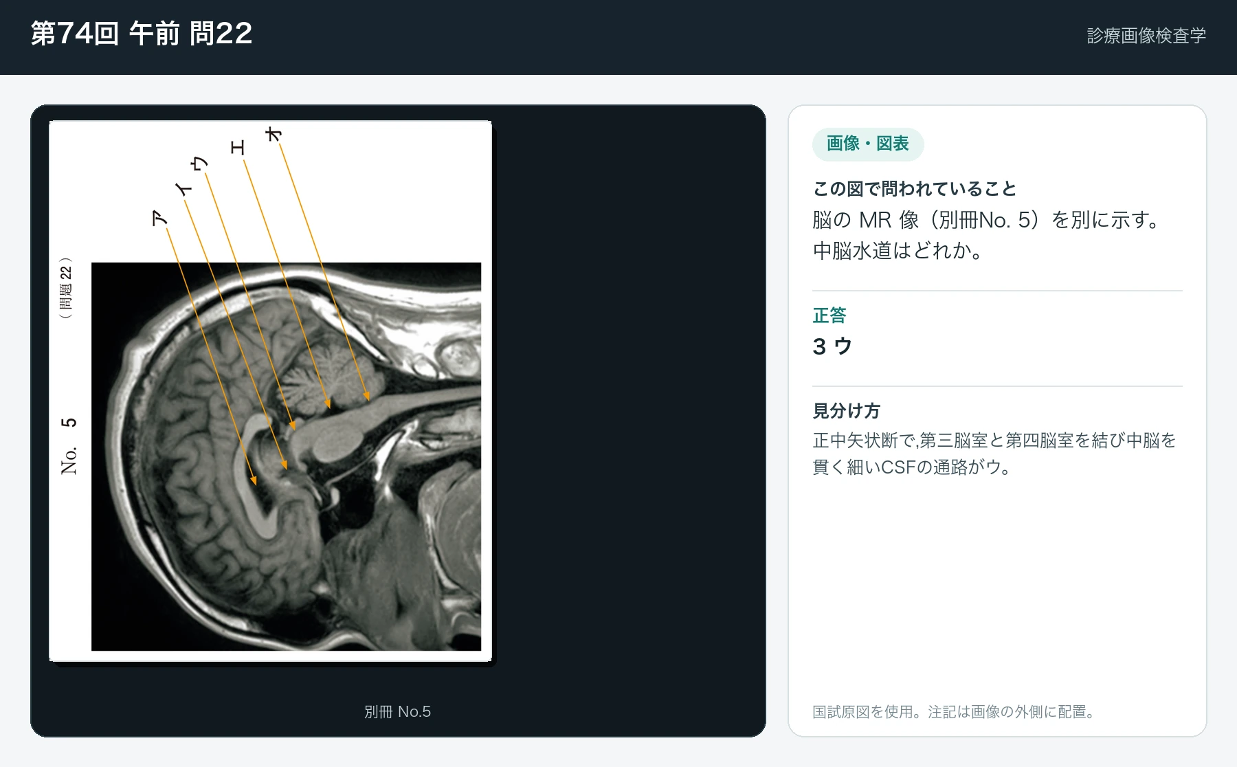 第74回 午前 問22の画像と見分け方