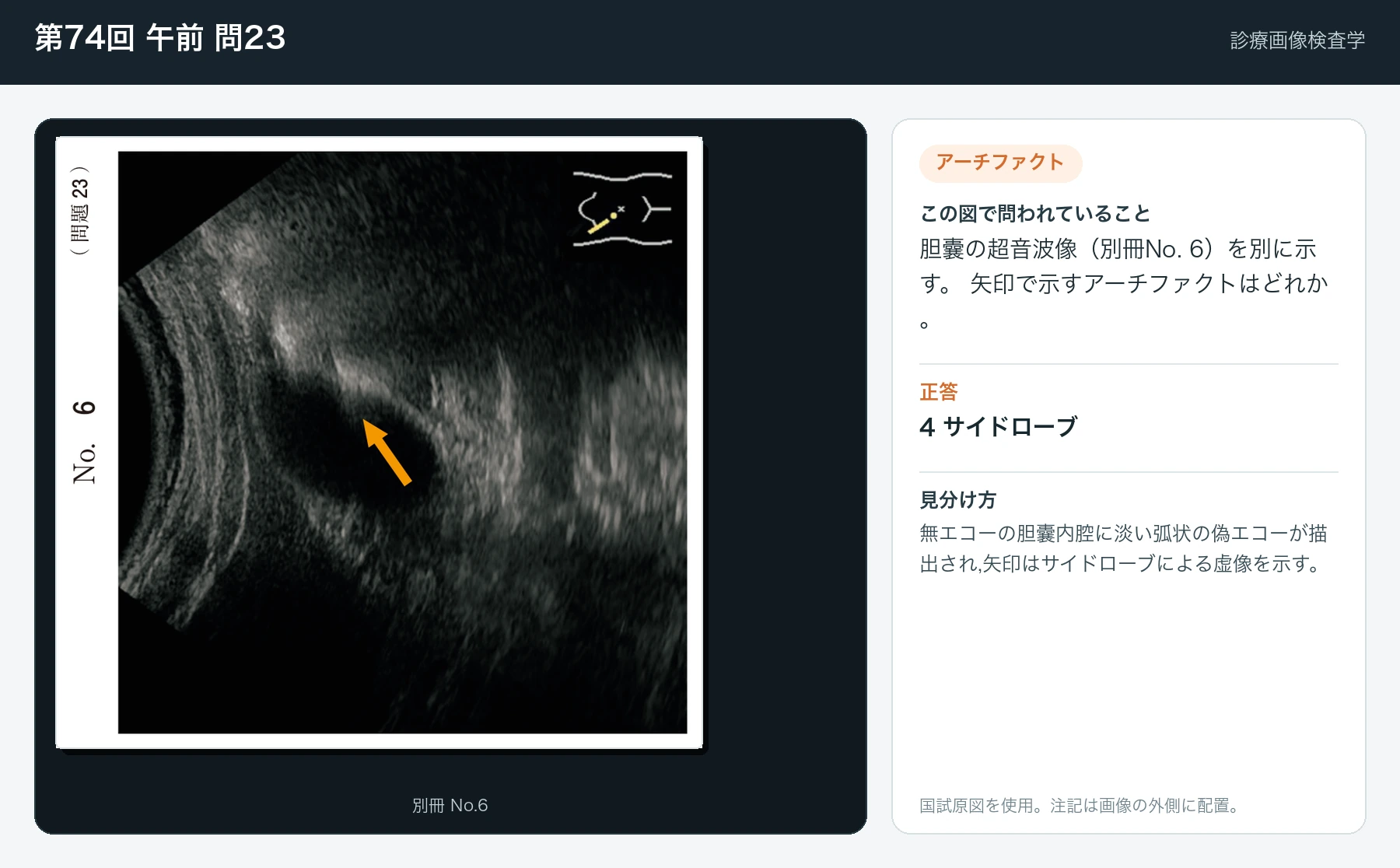 第74回 午前 問23の画像と見分け方