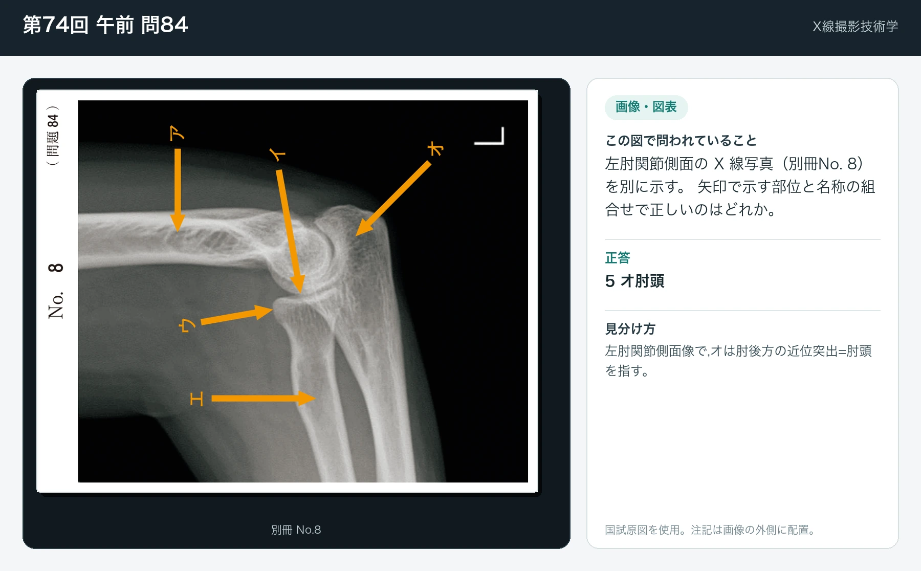 第74回 午前 問84の画像と見分け方