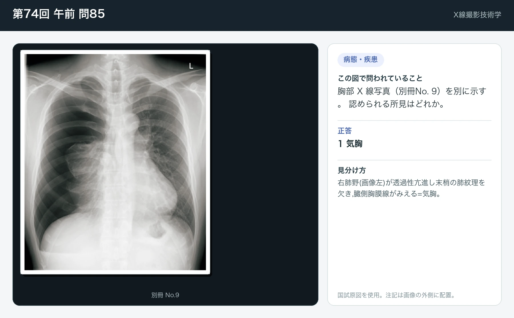 第74回 午前 問85の画像と見分け方