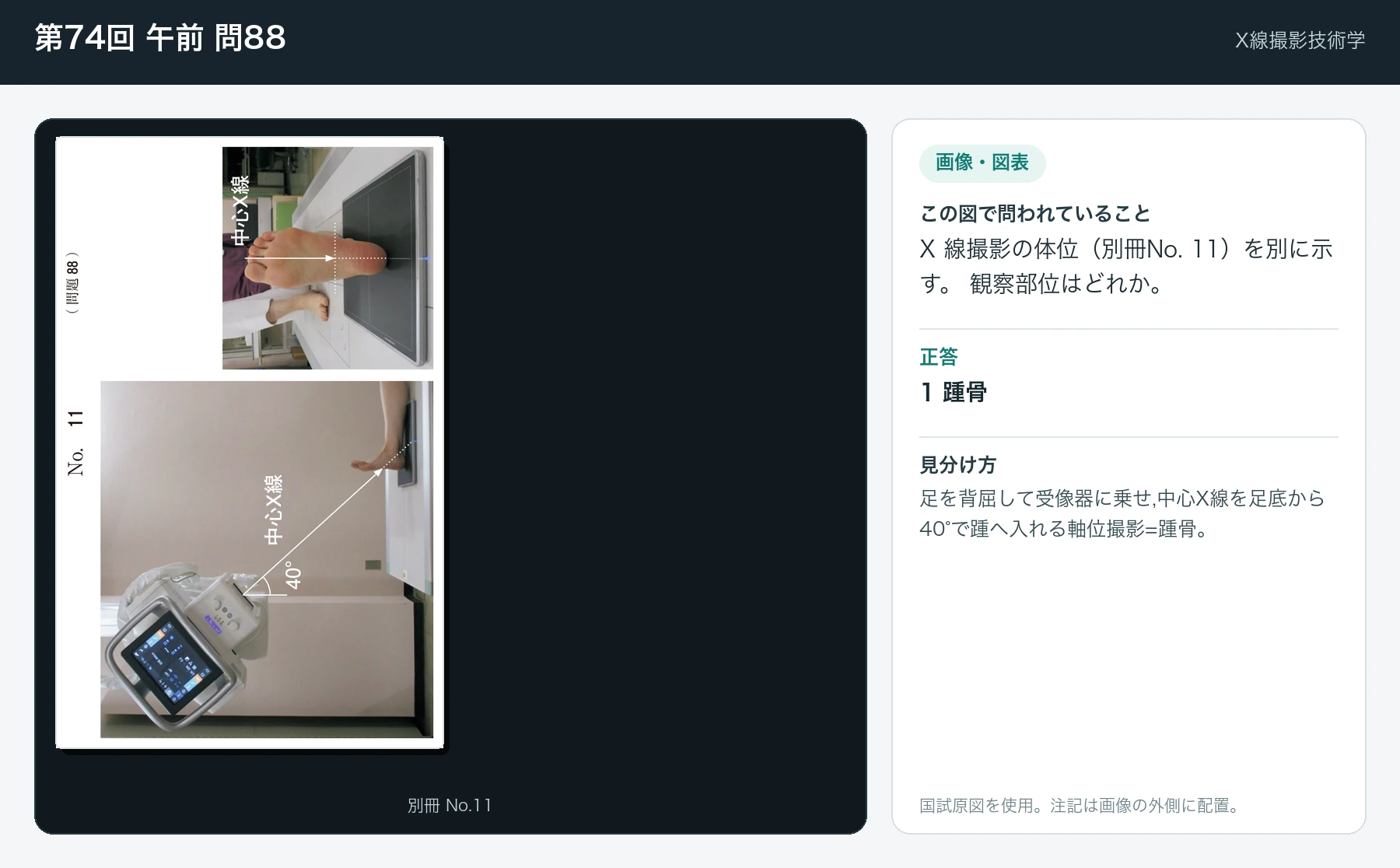 第74回 午前 問88の画像と見分け方