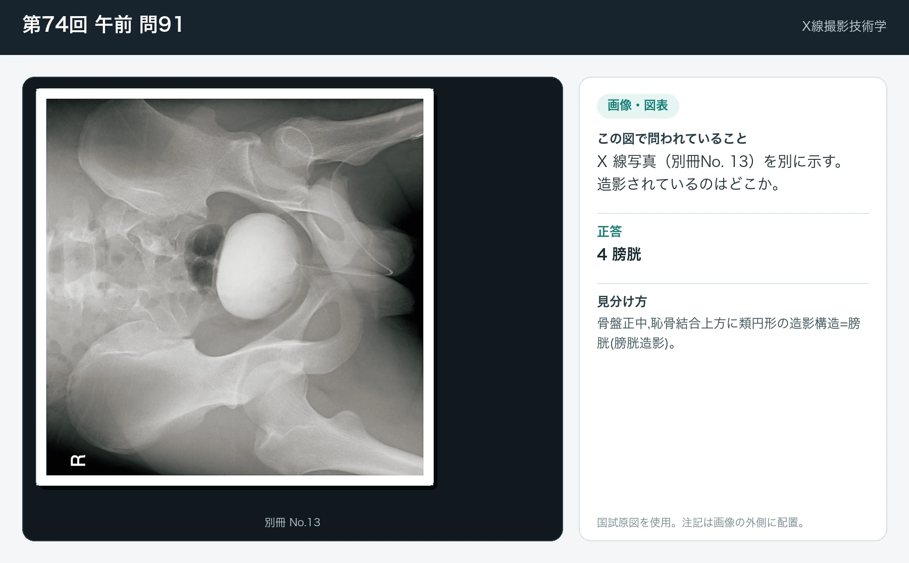 第74回 午前91の画像と見分け方