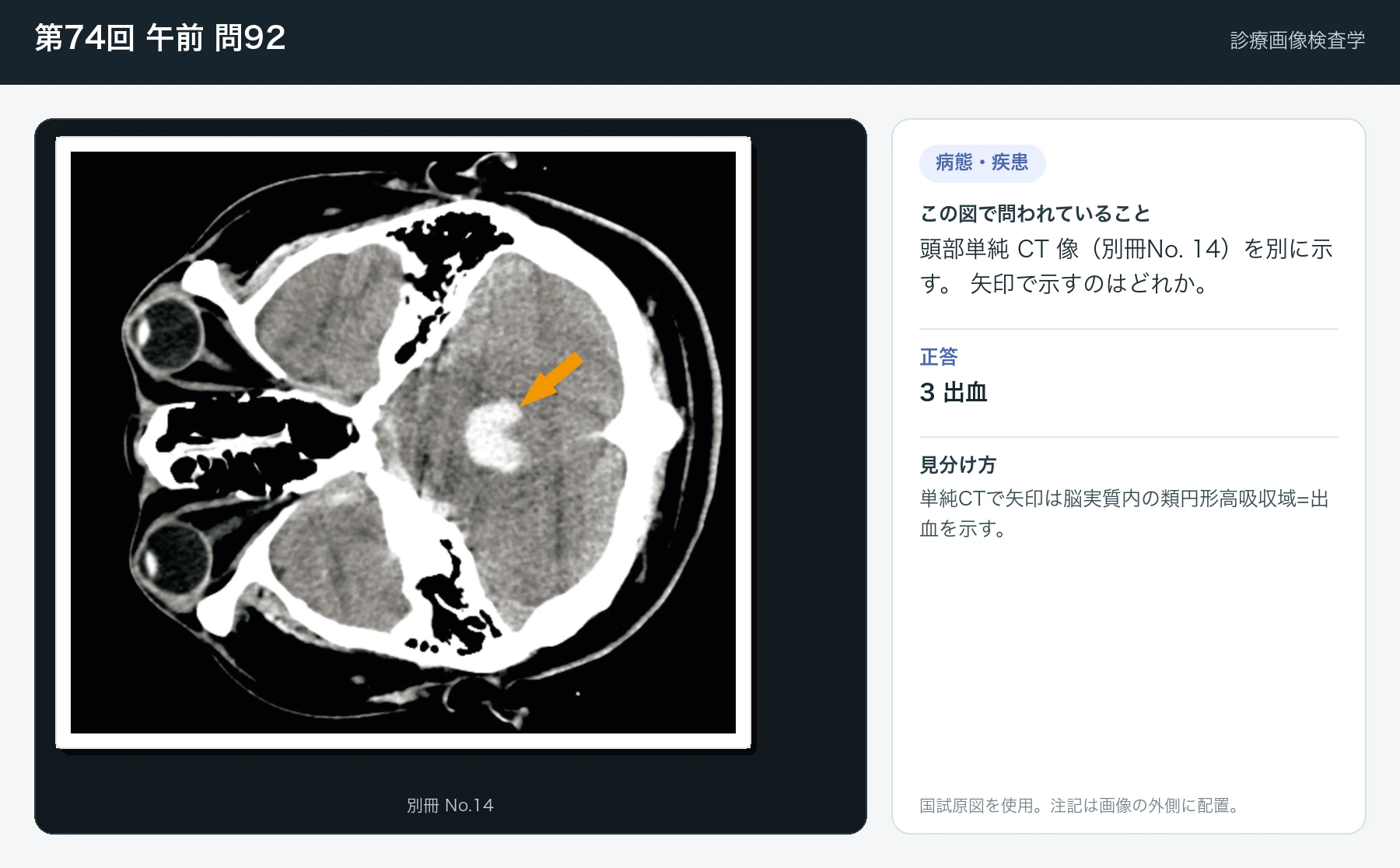 第74回 午前 問92の画像と見分け方
