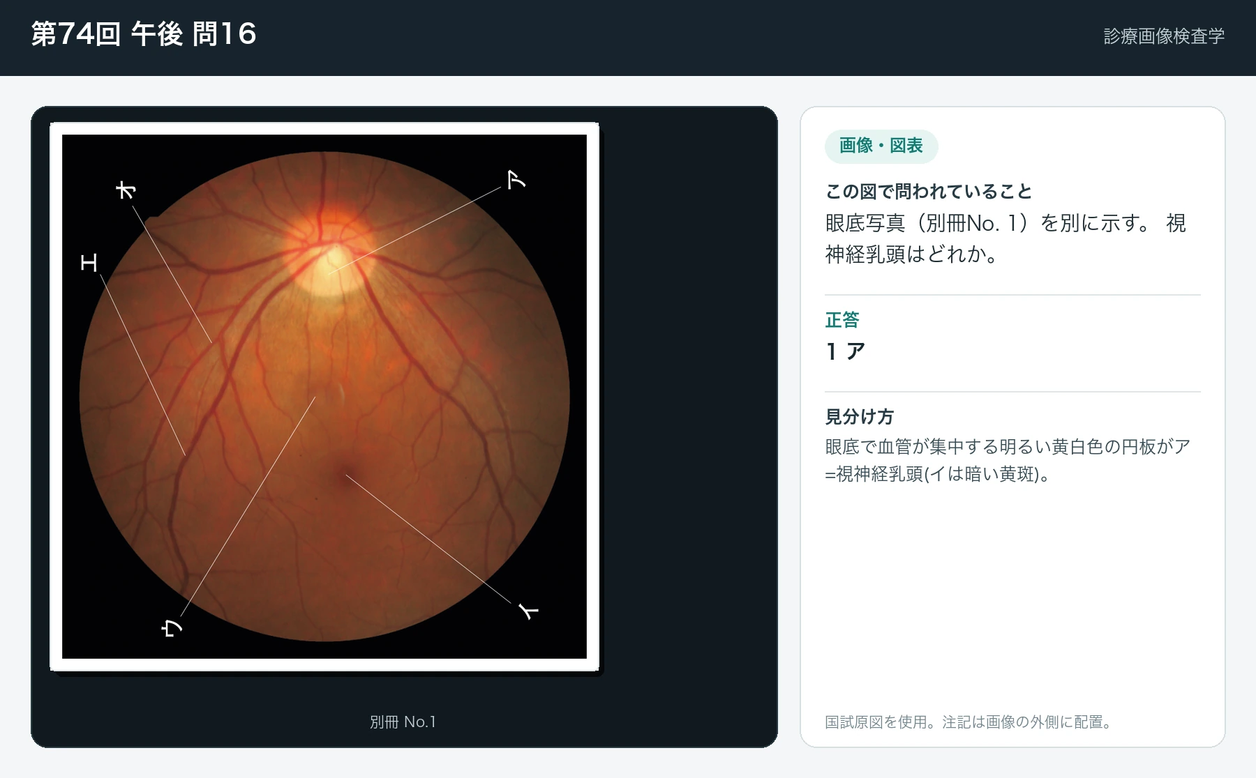 第74回 午後 問16の画像と見分け方