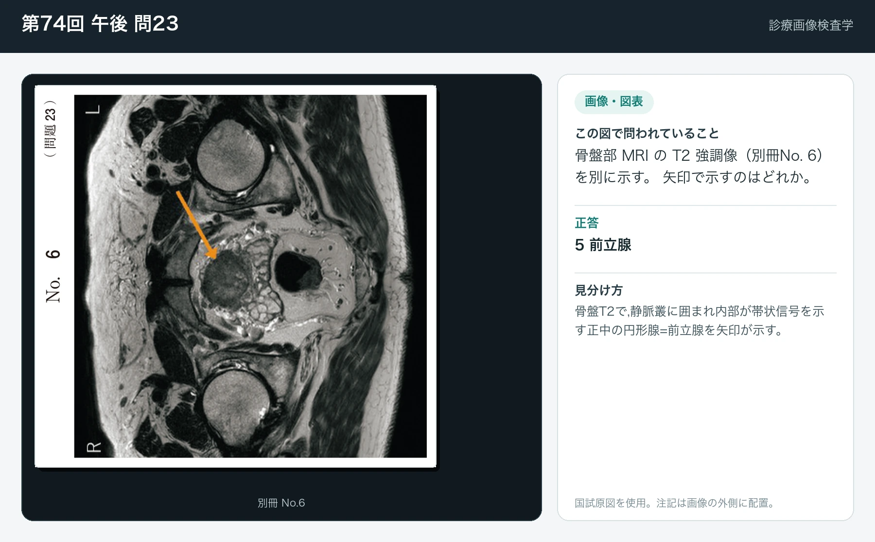 第74回 午後 問23の画像と見分け方