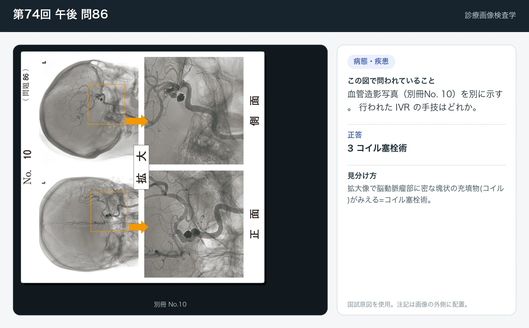 第74回 午後 問86の画像と見分け方