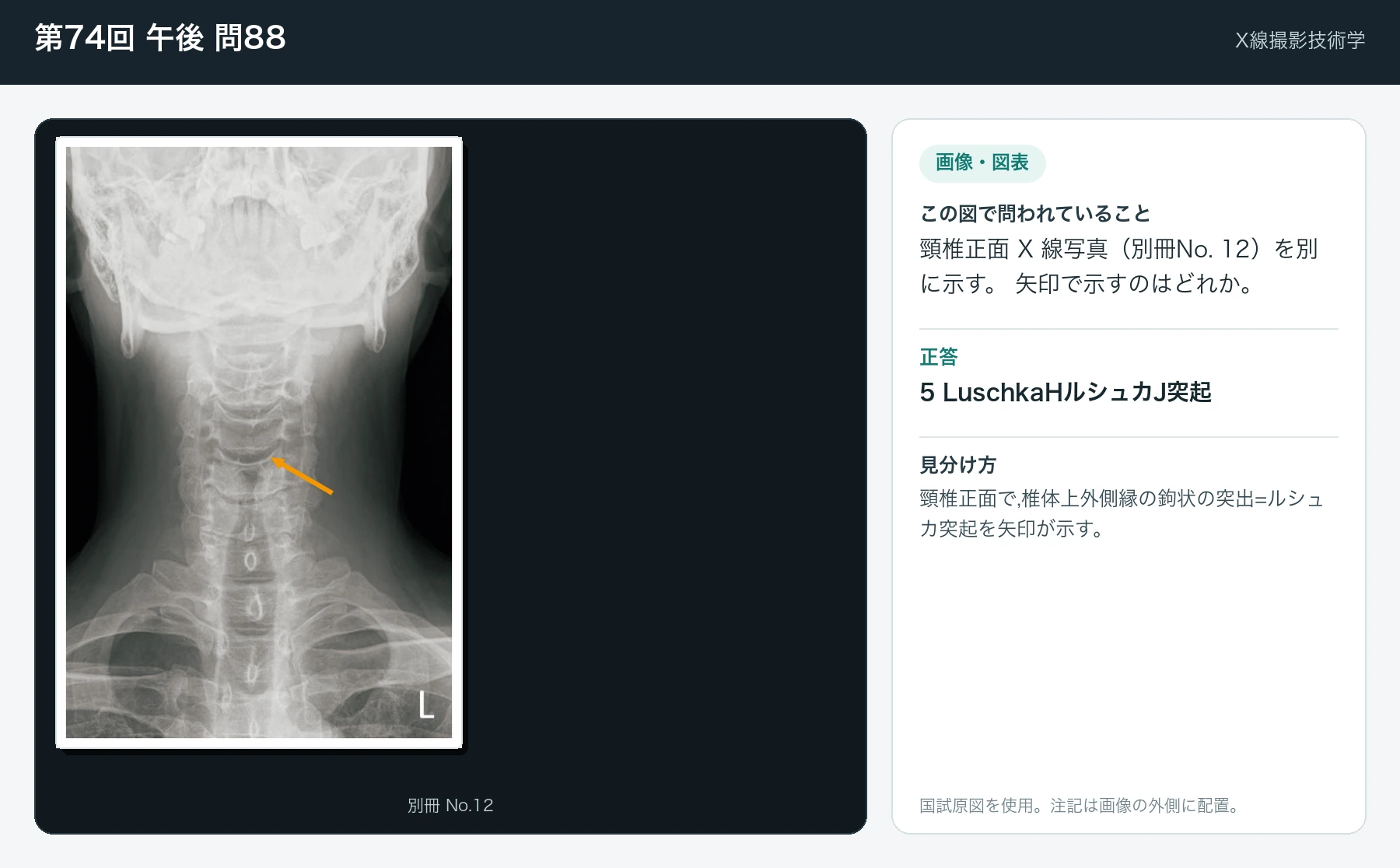 第74回 午後 問88の画像と見分け方