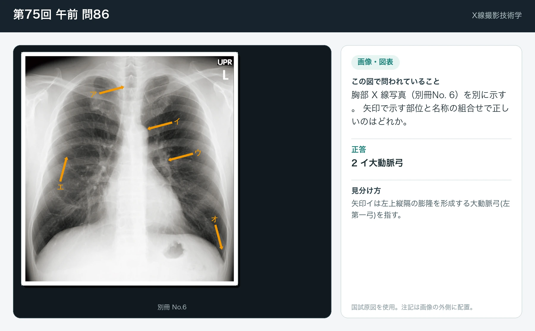 第75回 午前 問86の画像と見分け方