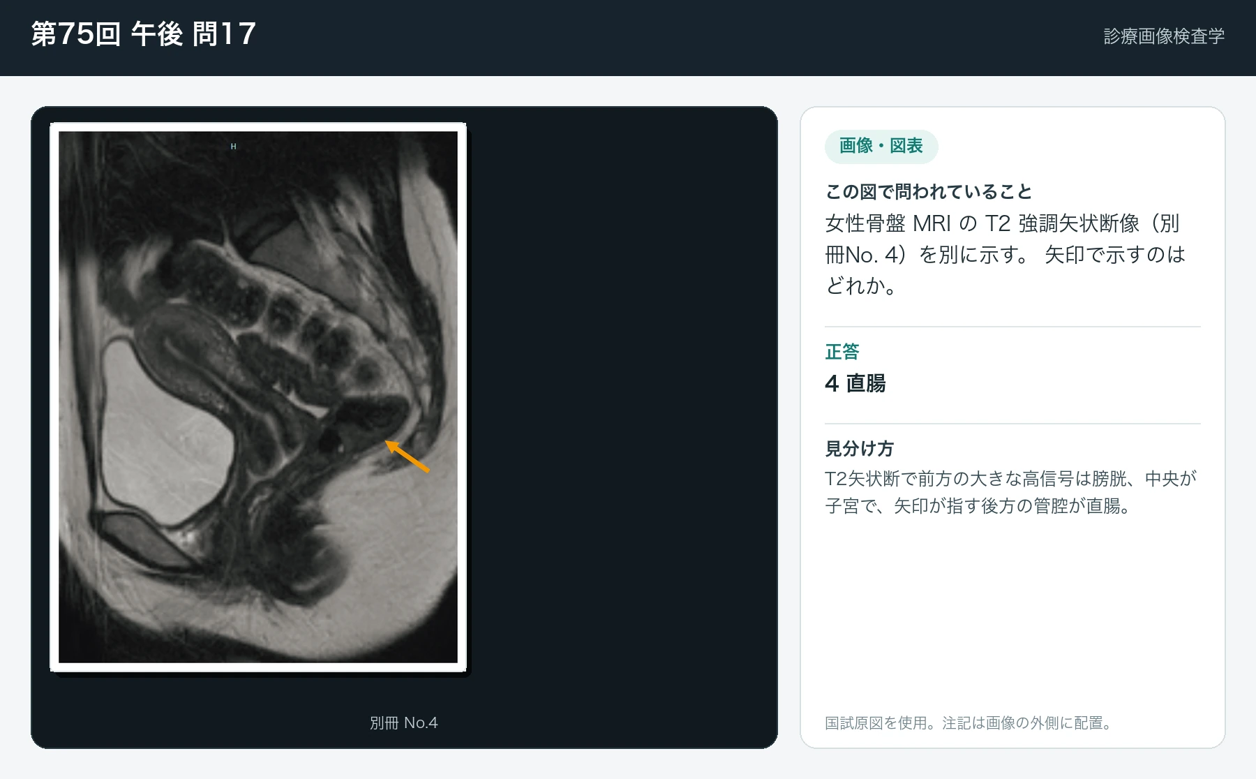 第75回 午後 問17の画像と見分け方