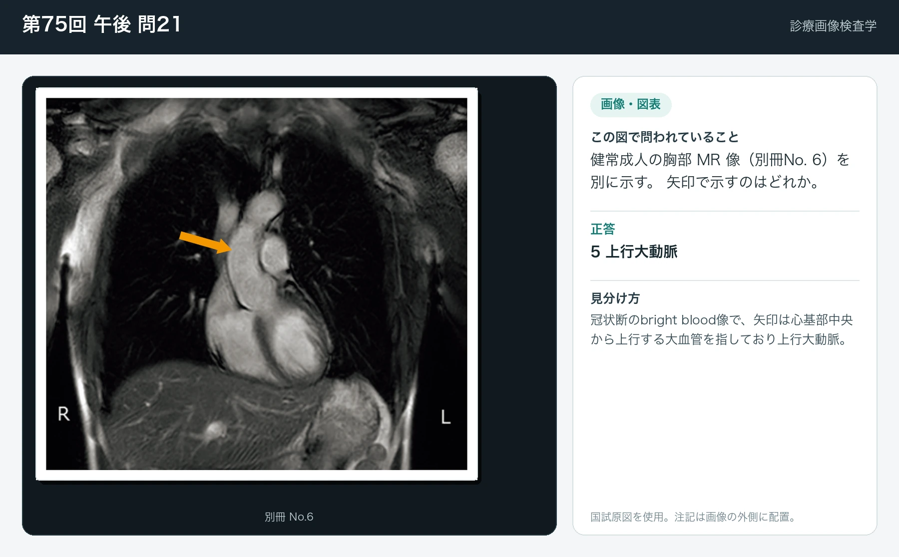 第75回 午後 問21の画像と見分け方