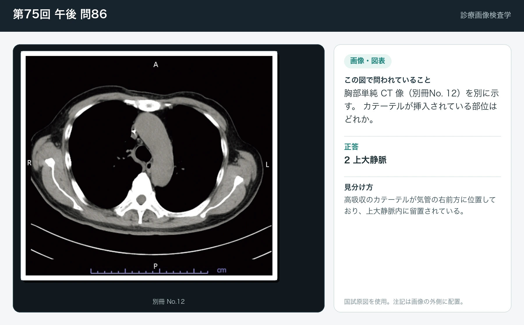 第75回 午後 問86の画像と見分け方