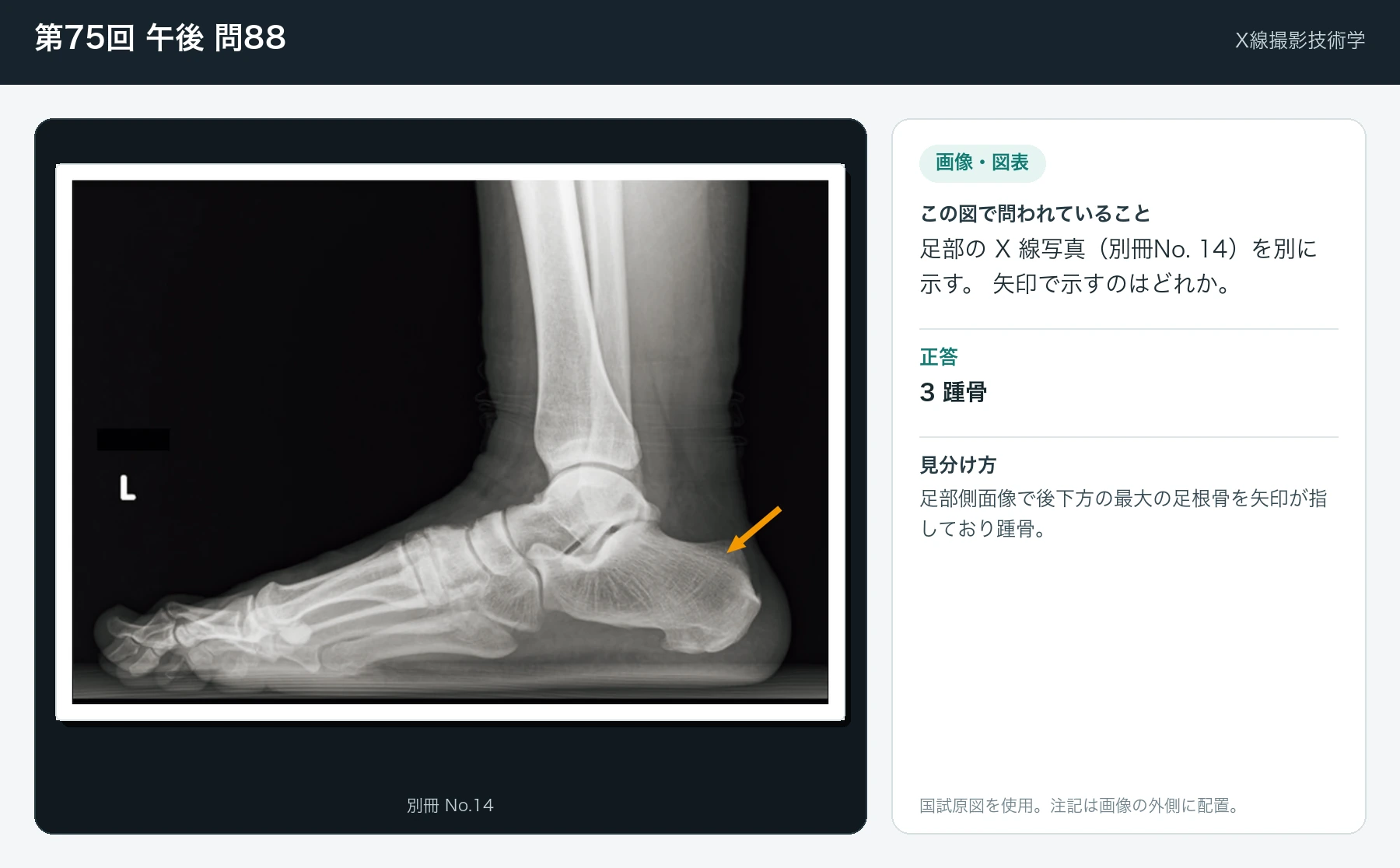 第75回 午後 問88の画像と見分け方