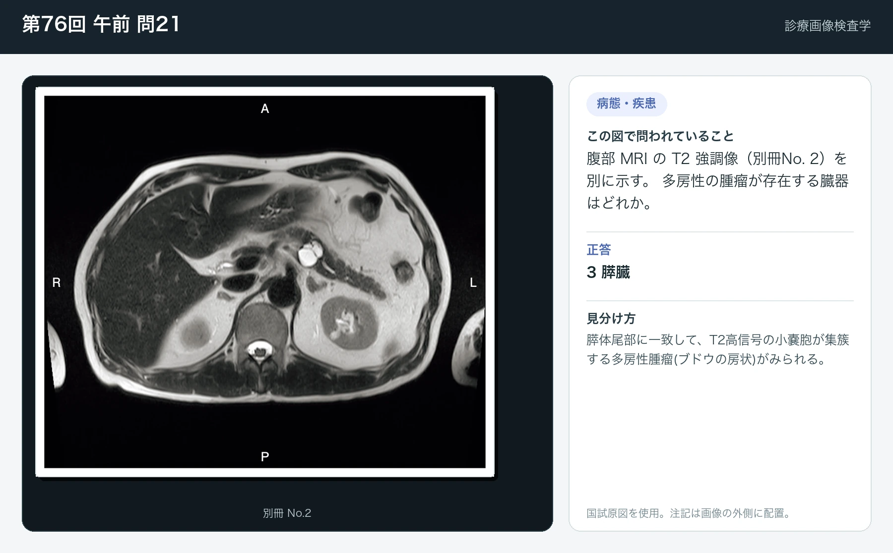 第76回 午前 問21の画像と見分け方
