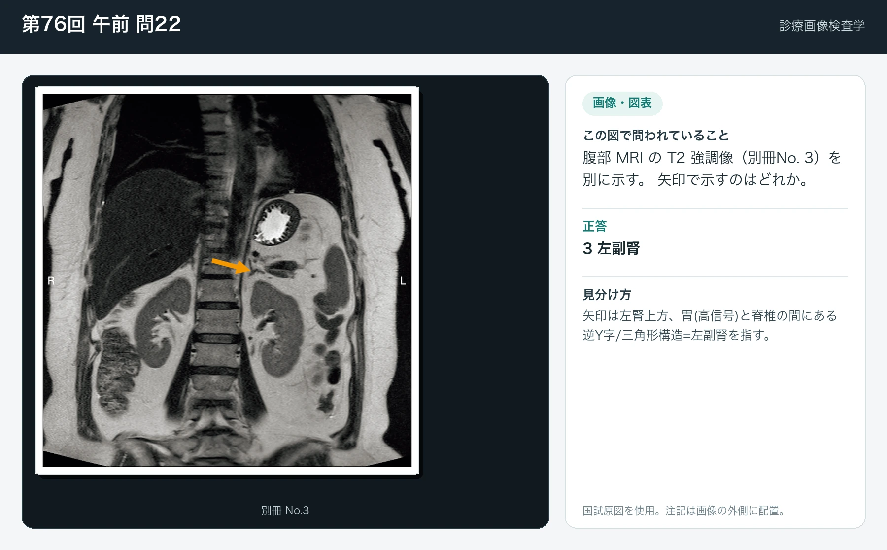 第76回 午前 問22の画像と見分け方