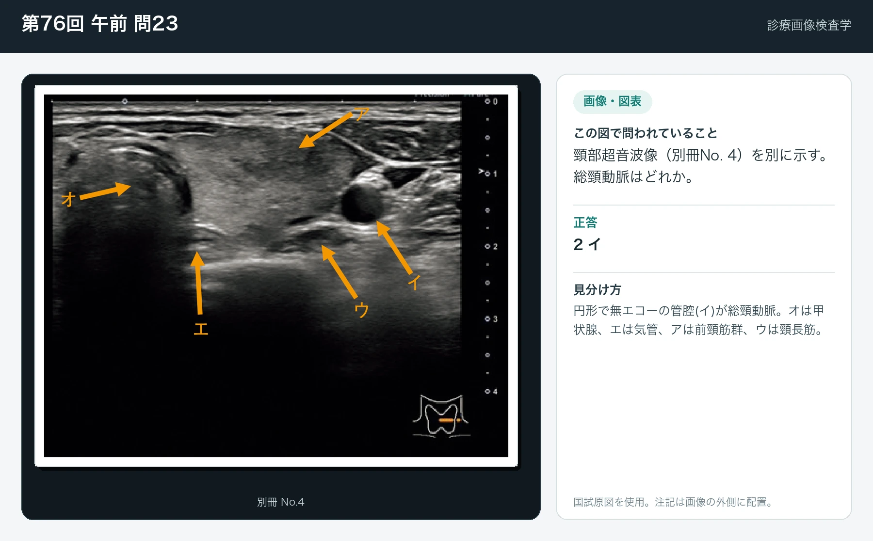 第76回 午前23の画像と見分け方