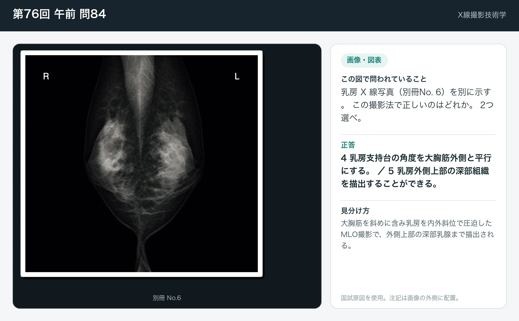 第76回 午前 問84の画像と見分け方