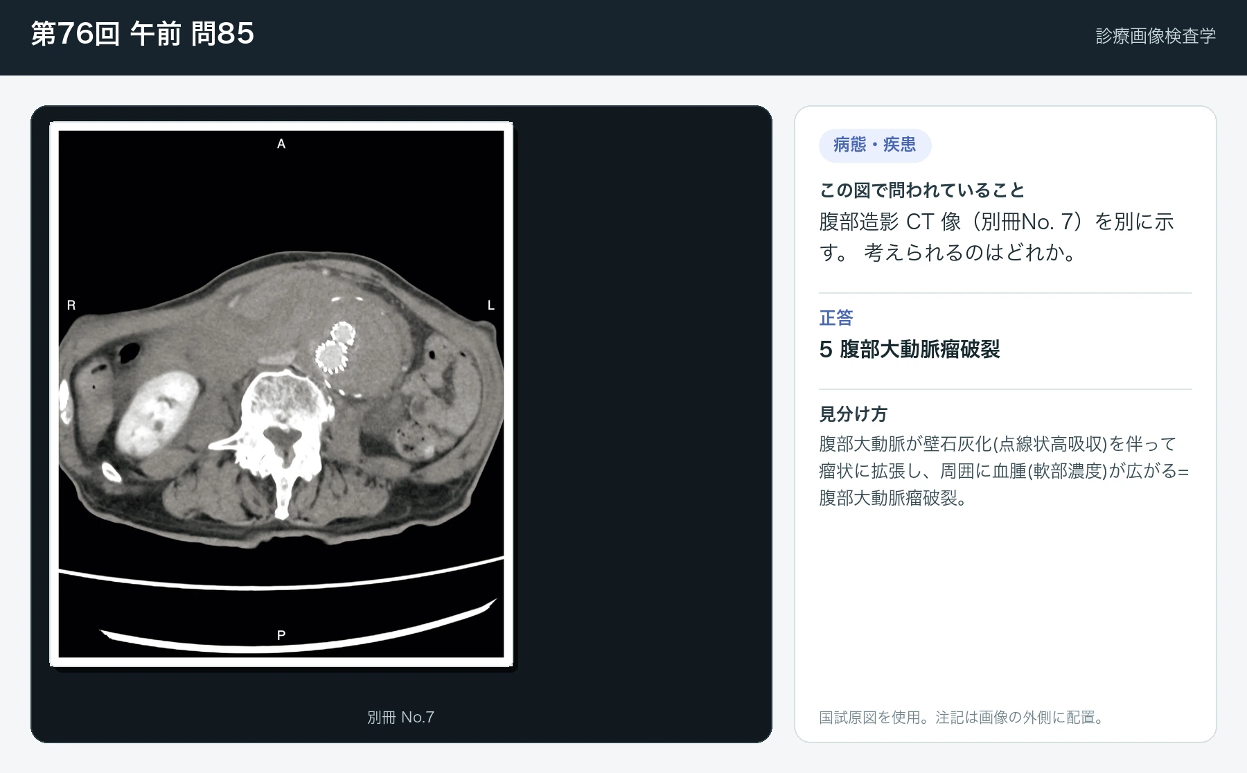 第76回 午前 問85の画像と見分け方