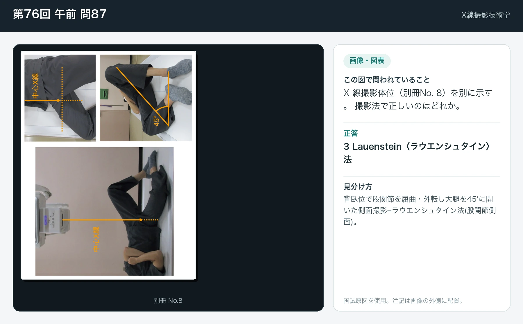 第76回 午前87の画像と見分け方