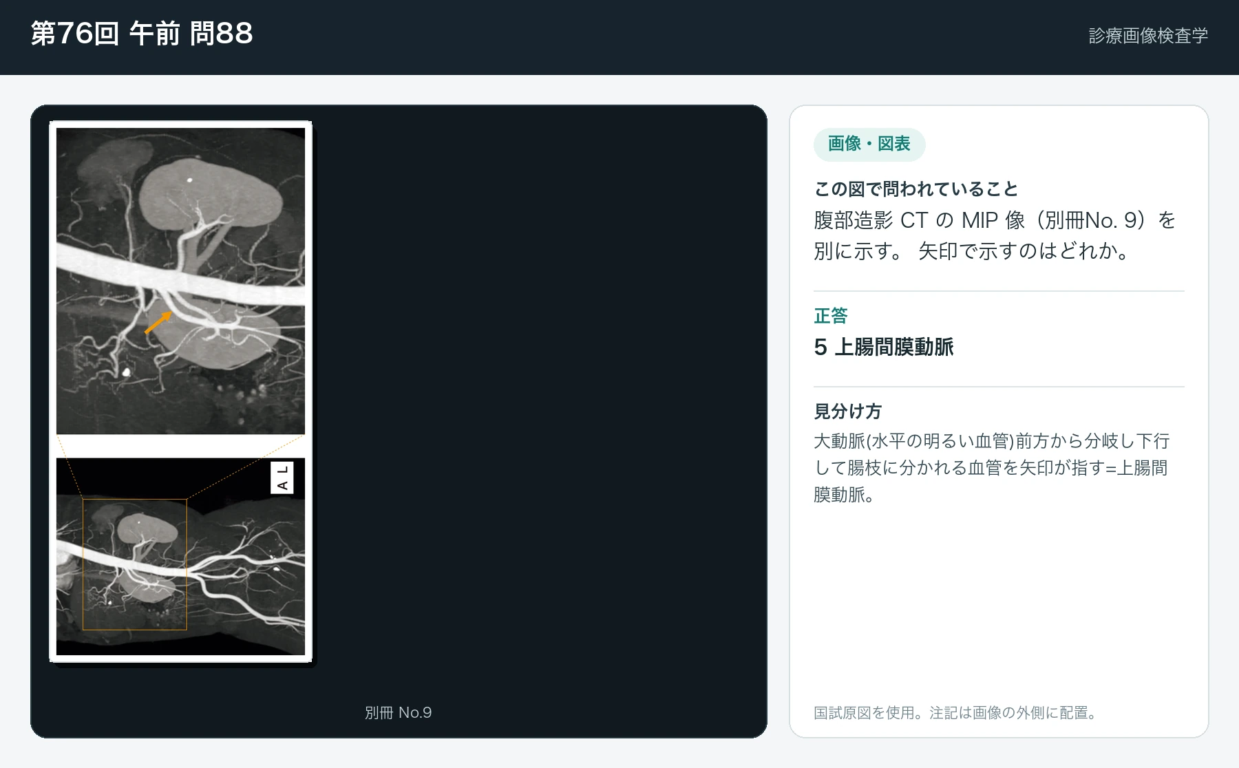第76回 午前 問88の画像と見分け方