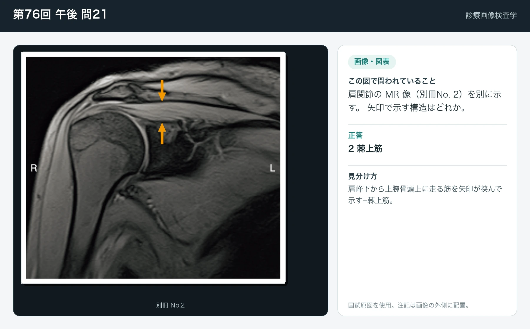 第76回 午後 問21の画像と見分け方